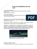 OCT en Agujero Macular