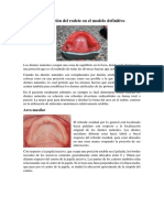 Orientación Del Rodete en El Modelo Definitivo