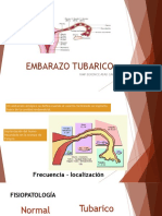 Embarazo Tubarico