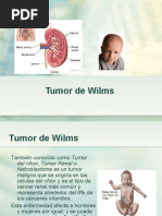 Tumor de Wilms