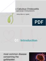 Chronic Calculous Cholecystitis