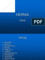 Clase Hernia Inguinal