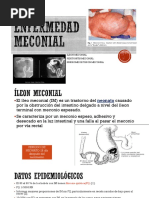 Ileon Meconial