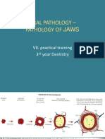 Oral Pathology - Pathology of Jaws