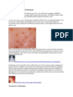 Varicella-Zoster Virus (Chickenpox) : Click The Icon To See An X-Ray of Pneumonia Following Exposure To Chickenpox