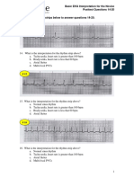 EKG Strips For Posttest Questions 14-20