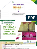 PB y Materia Alba