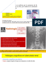 Tuberculosis Urogenital