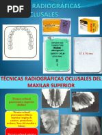 Tecnica RX Oclusal