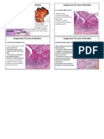 Gangrenous Necrosis of Intestine