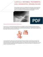 Asignacion Fractura de Clavicula