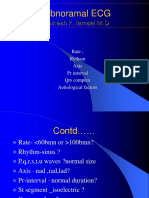 Abnoramal ECG