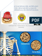 Osteopetrosis - Exposición