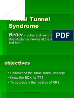 Tarsal Tunnel Syndrome