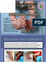 Pie Equino Varo Congénito