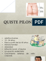 Quiste Pilonidal