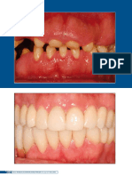  International Journal of Brazilian Dentistry - 2013