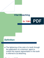 Vital Bleaching: Dr. Tom Dienya