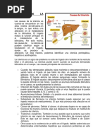 Causas y Tipos de Ictericia