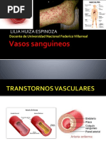 Vasculitis 1 y 2, Vasos Sanguineos