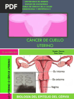 CA de Cuello Uterino Luis