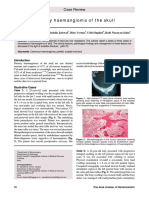 Primary Haemangioma of The Skull: Case Review