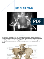 Pelvic Injuries