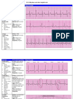 Rhythm ECG Characteristics Strip Example: ECG Rhythms and Other Helpful Tools