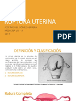 Ruptura Uterina