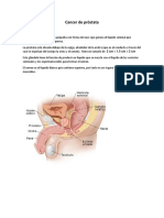 Cancer de Próstata