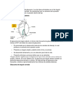 Tipos de Glaucoma