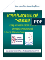 Radio Thorax PDF