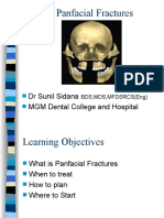 Panfacial Fractures: DR Sunil Sidana MGM Dental College and Hospital