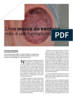 Artigo. Uma Marca de Ventosa Não É Um Hematoma Bruce Bentley