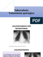 QX en Tuberculosis