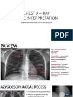 Chest X - Ray