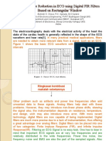 Interference Reduction in ECG Using Digital FIR Filters Based On Rectangular Window