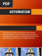 Astigmatism