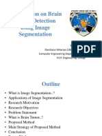 Presentation On Brain Tumor Detection