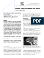 Giant Appendiceal Mucocele: Report of A Case and Brief Review