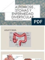 Anastomosis Estomas y Enfermedad Diverticular