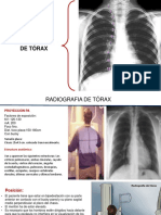 RX Torax