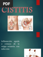 Cistitis