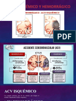 Acv Hemorragico e Isquémico - Liliana e Villavicencio Vera