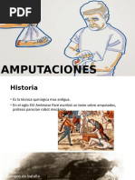 Amputaciones