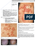 04 - Dermatose Eritemoescamosa