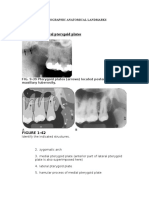 Medial and Lateral Pterygoid Plates: Periapical Film A) Maxilla