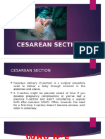 Cesarean Section and Surgical Instruments