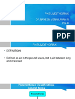 Pneumothorax: DR - Naveen Vennilavan R Pg-Iii