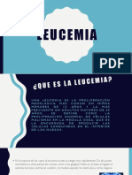 Leucemias Presentación